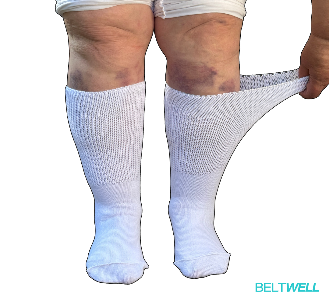 WideSox™ Super Stretchy Mobility & Balance Socks