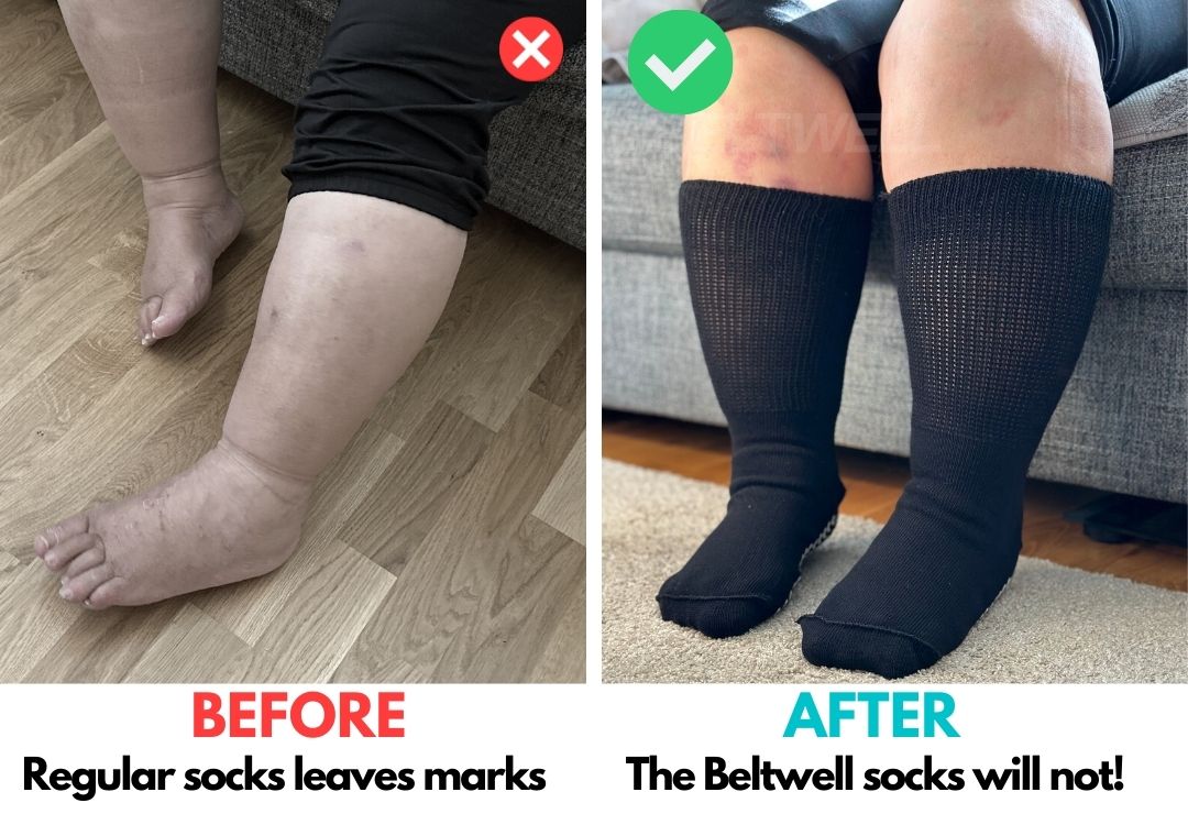 WideSox™ Super Stretchy Mobility & Balance Socks